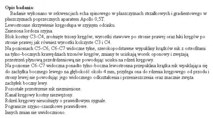 opiniaMRIszyjny.jpg (222.5 KiB) Przejrzano 49658 razy opinia lekarska po RMI odcinka szyjnego